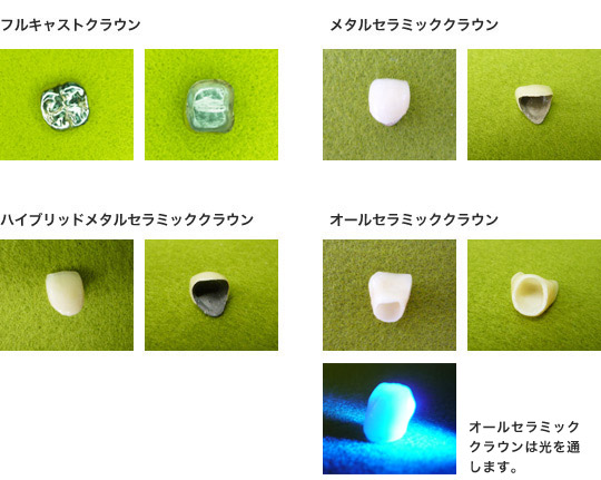 �S���������^�C�v