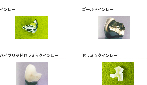 �����I�Ȓ����̎���