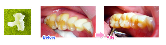 �Z���~�b�N�C�����[