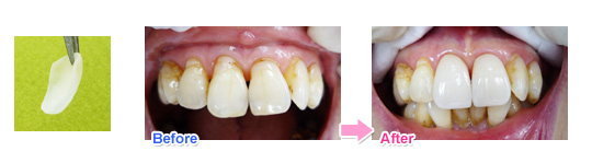 ���~�l�[�g�x�j�A