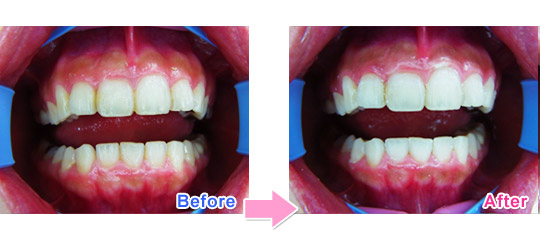 �I�t�B�X�z���C�g�j���O�Ǘ�01